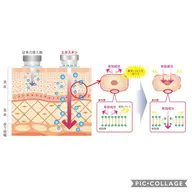 ニキビ、くすみでお悩みの方❗️乳酸ピーリング➕「VC20導入」エレクトロポレーション美白コース✨