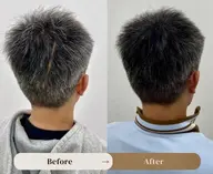 傷跡のお悩み解消ヘアアート（SMP）