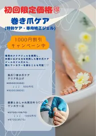 巻き爪ケア✋🦶🏻選択ＯＫ