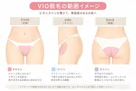 【はじめての方多数🍋】VIOシュガーリング｜やさしい脱毛｜モニター 期間限定価格