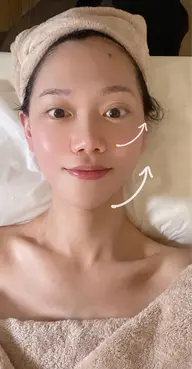 小顔コルギ＆毛穴洗浄💦