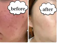 【人気No.1】オーダメイドフルコース🌈ご自身にあった肌別ケアをご提供🌱