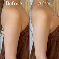 【マタニティ】結果重視のブライダル痩身＆小顔　100分