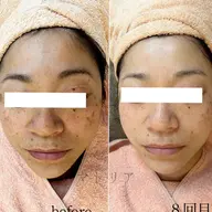 土台美容！年齢肌による、お悩みにアプローチ