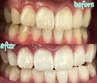 Ｂコース（8回）