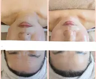 【フェイシャル】ポールシェリーアトニック フェイシャル  もたつき ラインをハーブで整える★フェイス & 全身 120分