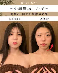 【人気NO.1🥇小顔＆たるみ改善】 頭蓋骨矯正+小顔矯正コルギ(首肩/デコルテ/二の腕オイルマッサージ付き)