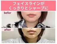 小顔になるだけじゃない💆‍♀️『お悩み改善小顔矯正マッサージ』」初回 🔰‪✨️