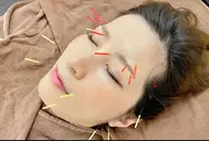 ハリウッド美容鍼灸®︎