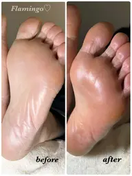 血行促進&くすみオフで【すべすべモチモチ角質ケア】