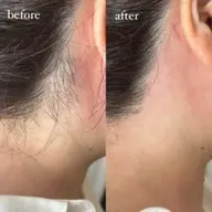 うなじWAXモデル、5名様募集🌻残り3名様