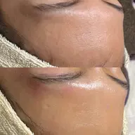 《潤艶全顔wax》ムダ毛を取り除きながら角質ケア🧖🏻♀️💎✨肌タイプに合わせた肌再生生パック付き💛