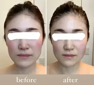 ご新規様様or半年以上ご来店のないお客様限定！顔骨気(コルギ)　即実感◎（施術時間４５分）