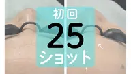 【初回価格】シワ・シミ・くすみなどお顔の部分ケアに 25ショット