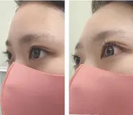 No.1人気☆4周年記念価格☆次世代まつげパーマ☆ラッシュリフト☆まつげ上下☆オフ無料☆ご新規様限定☆