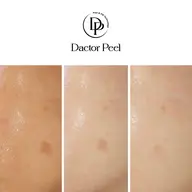 ララピールの進化版の第5世代ピール【ダクトピール】初回特別価格