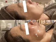 【年齢肌】年齢肌立て直すトータル集中ケアコース