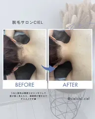 ★パーツ脱毛3ヶ所★お好きなパーツを選べます！