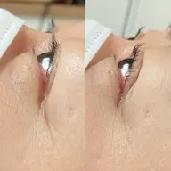 まつげカール（所要時間約40分）