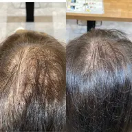 エアリーエクステ(ヘア増毛) 100本〜