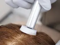 頭皮ケアエステ・ヒト骨髄幹細胞成長因子を使ったトリートメント　※口コミモデル様募集！