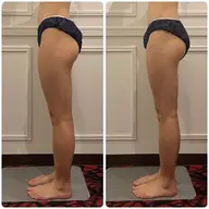 気になる脚に徹底アプローチ🔥ハイパーナイフEXとハイパーシェイプの最強の合わせ技★むくみ解消&セルライト&ヒップUP