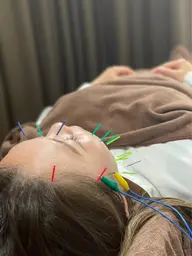 肌荒れに😵電気美容鍼&リンパマッサージ