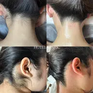 【VIO+うなじワックス脱毛】