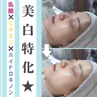 〈美白特化🤍〉ホワイトスノーピール　(剥離&ダウンタイムなし) 70分5,000円
