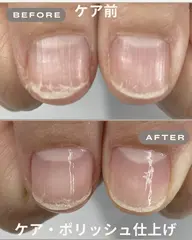 ネイルケアモニター・ポリッシュ仕上げ