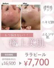 《圧倒的ツヤ肌🫧》ララピール💎韓国で爆発的人気👑韓国人肌に✨