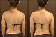 腸もみ×全身リンパで内側から整え、むくみ・便秘・肩こりスッキリ✨1回でも変化を実感しやすく、ウエストや姿勢も整います🌿