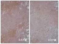 【ミニモ学割/毎月3名様】リフトアップ/美白/毛穴引き締め効果あり🫧超音波エステ