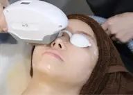 【メイクのりに差が出る】産毛・毛穴悩みにオススメ◎ 顔脱毛