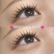 バインドロック80セット