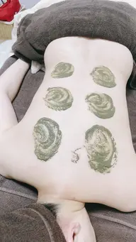 【背中ニキビケア】剥けないハーブピーリング+美容液導入付き。肩〜腰までしっかりケア 定価22,000円