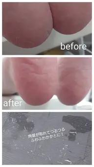 つるふわかかとケア