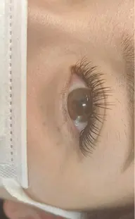 バインドロック100束