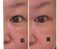 🌹角質ケアに🌹ピーリング（ゴマージュ系）＋フェイシャルトリートメント