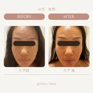 ボディ＆フェイシャル極上美活フェイシャル120分