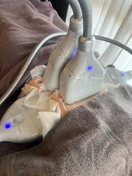 【前・当日ご予約限定価格❣️】冷却痩身❄️表面4カップ✨お好きな箇所