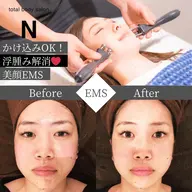 【minimo限定✨大事な予定前に即効むくみ＆贅肉撃退🔥】 美顔EMS（50分） 通常11,000円 → 4,500円