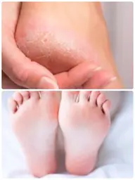 【全員使用可】足裏ケア👣✨いらない足の角質を取り除きます🔸ストッキングが引っかかる方🔸足の臭いが気になる方