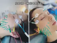 【左右差・フェイスラインケア】美容整体×EMS×美容鍼