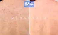 今話題✨️“プラズマニア” \群馬県初導入サロン🌷/ 導入キャンペーン〖ボディ気になる1箇所〗40分コース 男性もOK