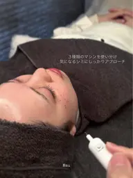 シミケア美白トリートメント(マシン付き)