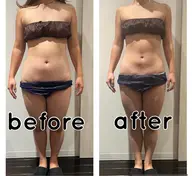 🌻男女OK【目指せ美ボディーお腹スリム】🌻キャビ+ラジオ波+手技