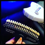 【なるべく早く歯を白くみせたい方へ☆】セルフホワイトニングで汚れ除去