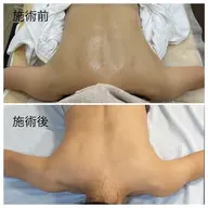 全身マッサージ60分、手から電気を流す施術のため、ペースメーカーやてんかんの方は申し訳ございませんが禁忌となります。