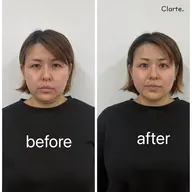 \\SNSモニター募集//驚きの変化✨小顔整顔・根本改善コース💆‍♀️￥7,500→￥2,500❣️